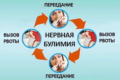 Лечение булимии в Кыштыме